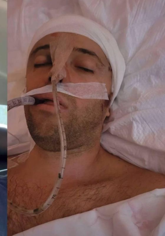 Насильно мобилизованный тренер по брейк-дансу умер в Черкасской области