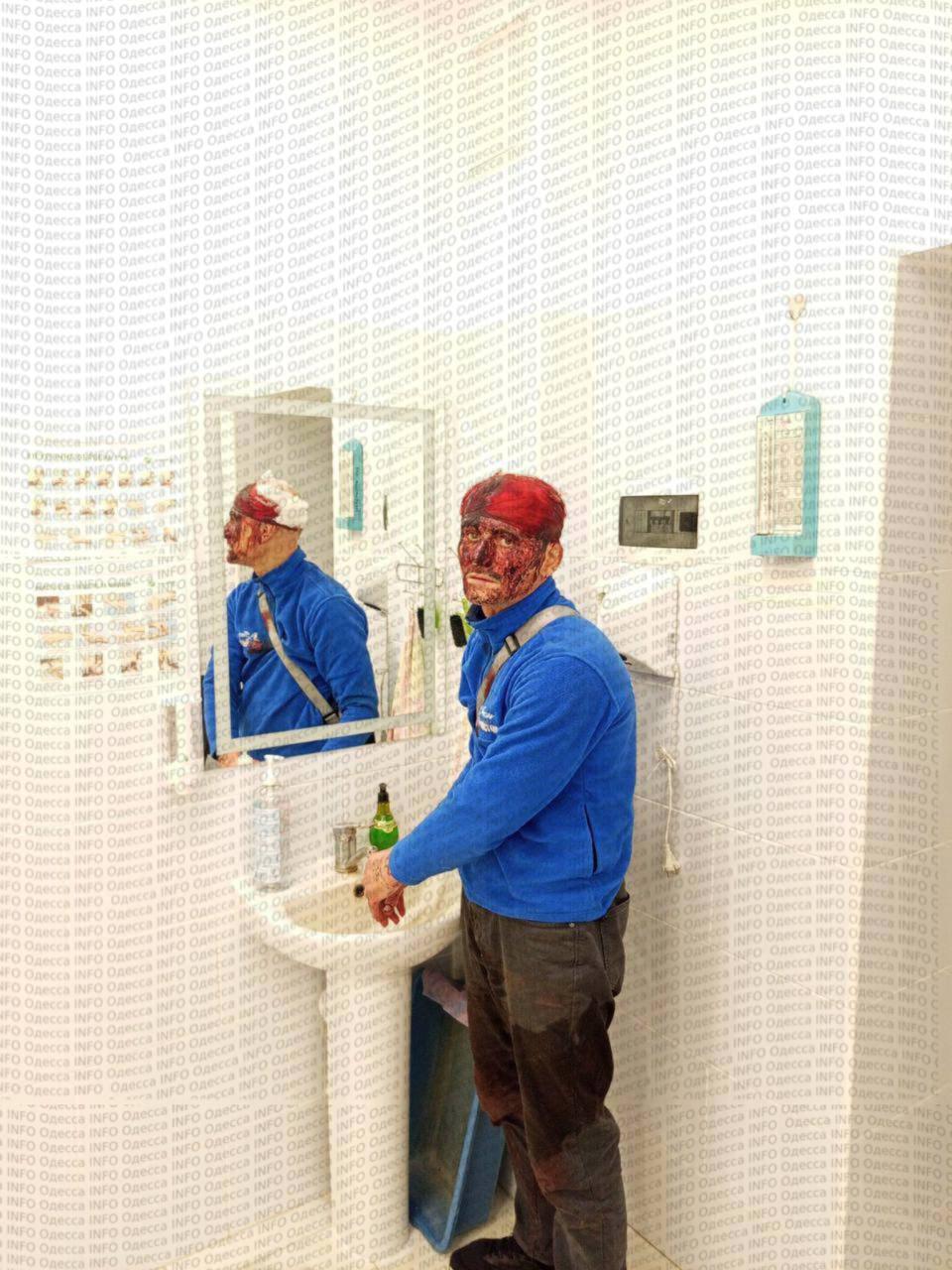 Сказки от ТЦК: сам себя избил до полусмерти