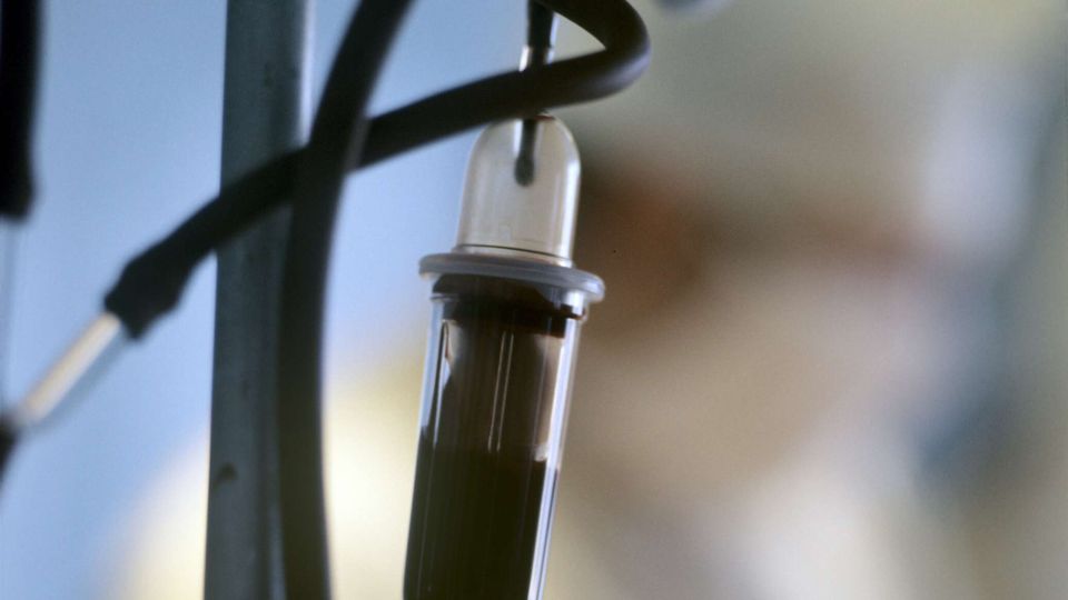 В Одессе мужчина пытался отпилить себе руку и избежать мобилизации