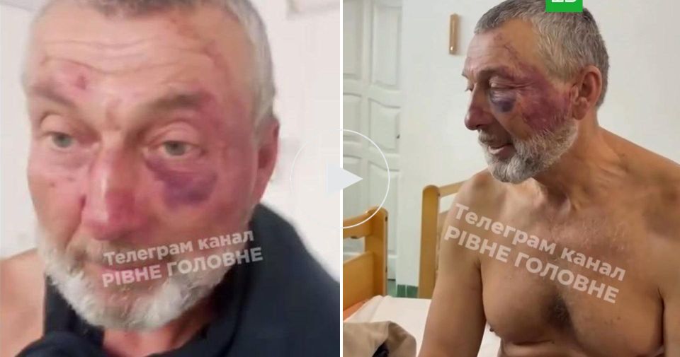 Украинские военкомы переломали ребра 61-летнему ветерану афганской войны