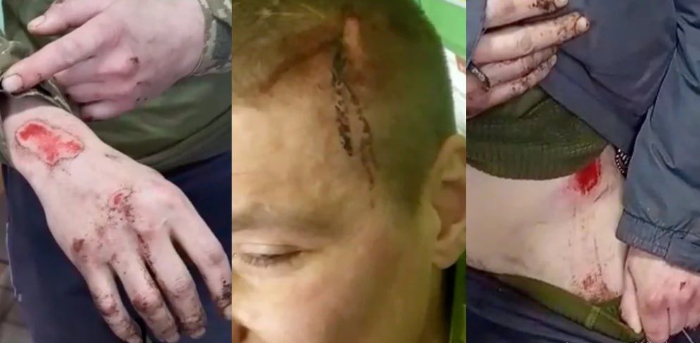 Жуткие подробности издевательств над насильно мобилизованными в «Курятнике» Сырского