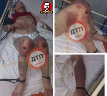 В Киевской области мужчину госпитализировали в тяжёлом состоянии после нескольких дней в Белоцерковском ТЦК