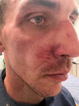В Польше продолжаются избиения украинских беженцев