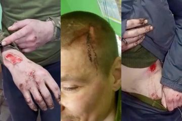 Украина: обстрелы собственных солдат и пытки, новый скандал в армии Зеленского