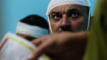 "Госпитали переполнены": Алехин про огромные потери ВСУ на Харьковском и Сумском направлениях