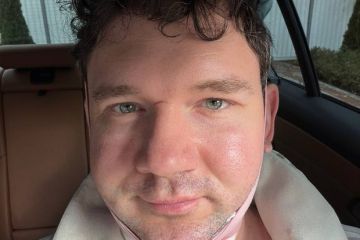 Блогер Стас Васильев рассказал, что ему сделали операцию